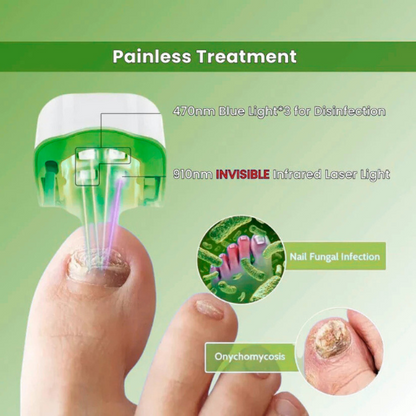 Vivadrop™ - Nail Fungus Laser