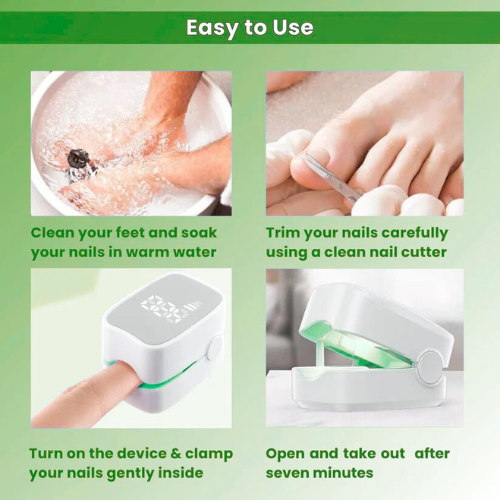 Vivadrop™ - Nail Fungus Laser